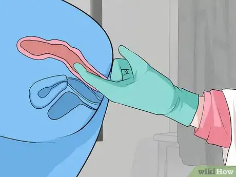 Imagen titulada Detect Appendicitis During Pregnancy Step 13