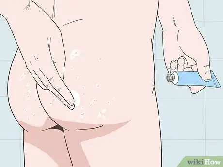 Imagen titulada Treat Buttock Folliculitis Step 4