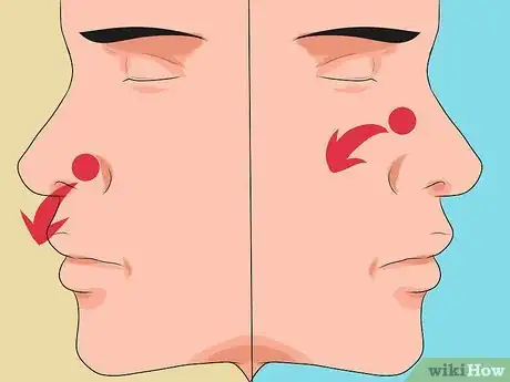 Imagen titulada Stop a Nose Bleed Step 12