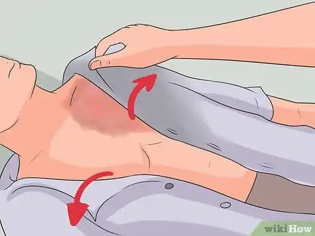 Imagen titulada Treat a Hot Water Spill on Your Skin Step 13