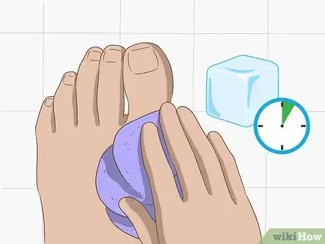 Imagen titulada Stop a Bunion from Growing Step 10