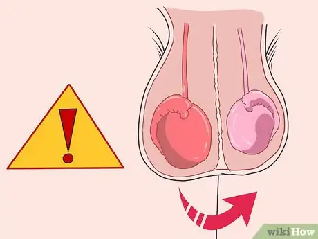 Imagen titulada Know if You Have Epididymitis Step 1