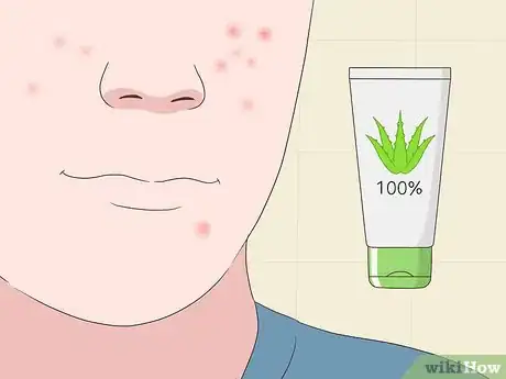 Imagen titulada Use Aloe Vera Gel on Your Face Step 5