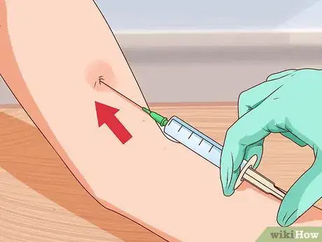 Imagen titulada Recognize Tetanus (Lockjaw) Step 11