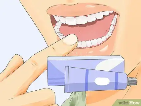 Imagen titulada Get Rid of White Spots on Teeth Step 10