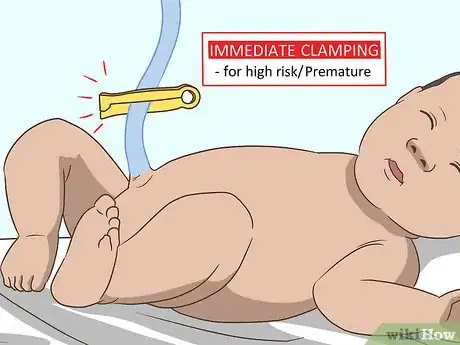 Imagen titulada Cut the Umbilical Cord of a Baby Step 2