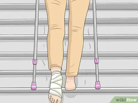 Imagen titulada Go Upstairs with Crutches Step 15