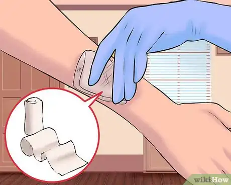 Imagen titulada Use a Band Aid Step 11