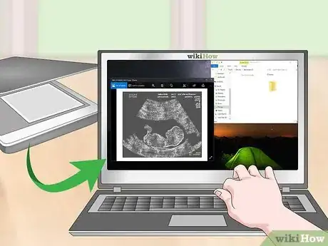 Imagen titulada Store Ultrasound Photos Step 8