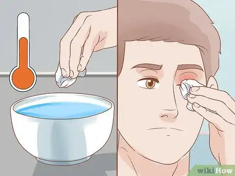 Imagen titulada Heal a Swollen Eyelid Step 6