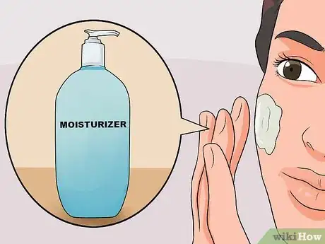 Imagen titulada Get Rid of Acne Blemishes Step 5