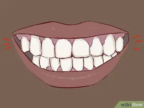Imagen titulada Treat a Broken Tooth Step 17