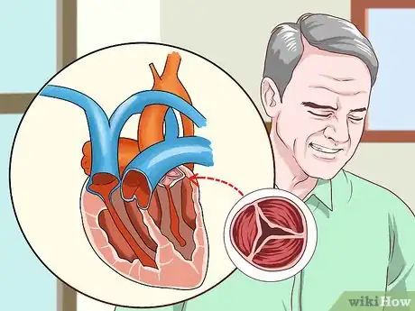 Imagen titulada Treat Obstructive Shock Step 5