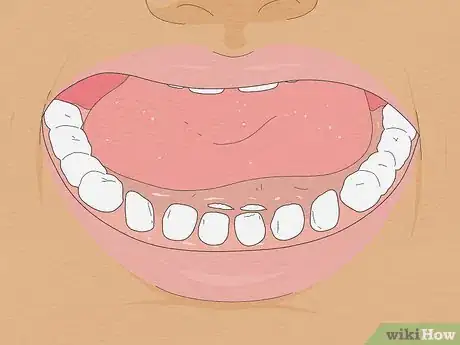 Imagen titulada Pull a Loose Tooth at Home Step 15