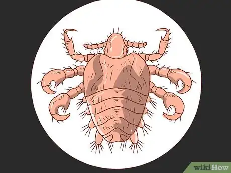 Imagen titulada Treat Crabs (Pubic Lice) Step 1