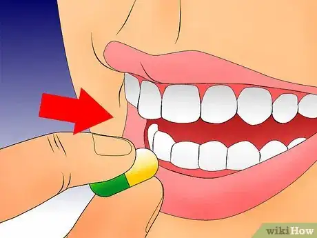 Imagen titulada Get Rid of Gingivitis Step 8