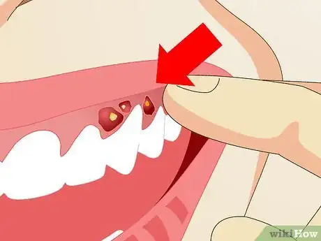 Imagen titulada Remove Bad Breath Step 15