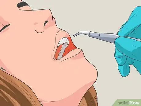 Imagen titulada Overcome Your Fear of the Dentist Step 4