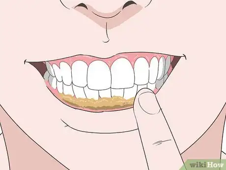 Imagen titulada Treat a Gum Infection Step 2