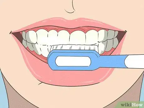 Imagen titulada Fix Nicotine Stained Teeth Step 13