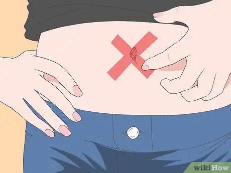 Imagen titulada Treat an Infection in Your Belly Button Step 10