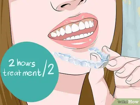 Imagen titulada Use Teeth Whitening Gel Step 13