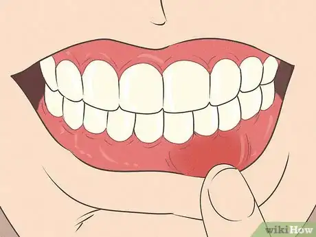 Imagen titulada Fix Nicotine Stained Teeth Step 12