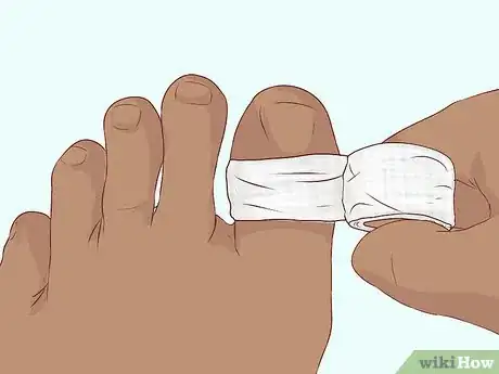 Imagen titulada Bandage Fingers or Toes Step 14