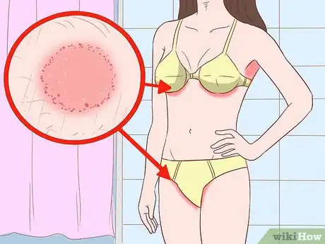 Imagen titulada Prevent Skin Fungus Step 2