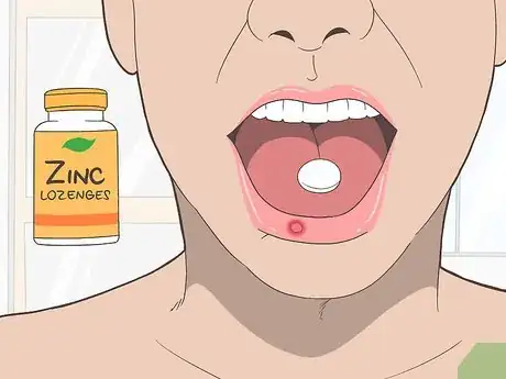 Imagen titulada Treat Mouth Ulcers Naturally Step 11