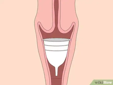 Imagen titulada Shorten Your Period Step 7
