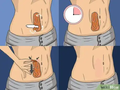 Imagen titulada Remove Stomach Hair Step 3