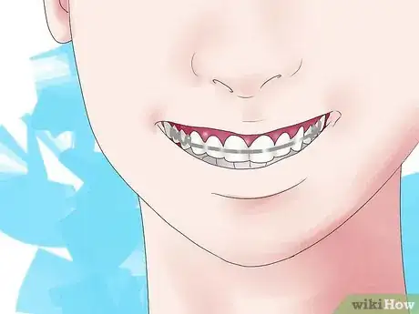 Imagen titulada Fix Crooked Teeth Step 11