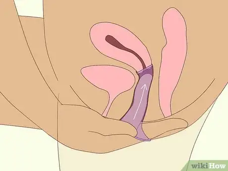 Imagen titulada Use a Female Condom Step 10