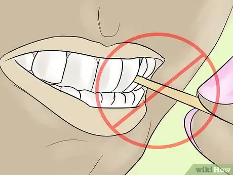 Imagen titulada Eat With Separators in Your Mouth Step 5
