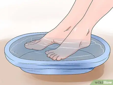 Imagen titulada Treat a Corn or Callus Step 7