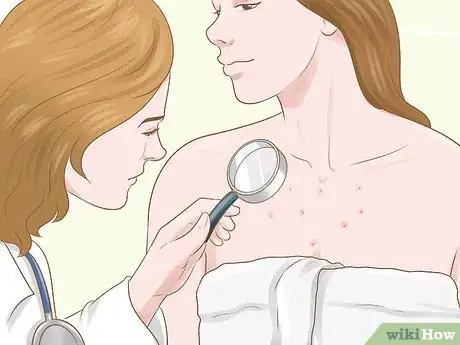 Imagen titulada Get Rid of Acne Scars on Your Chest Step 1