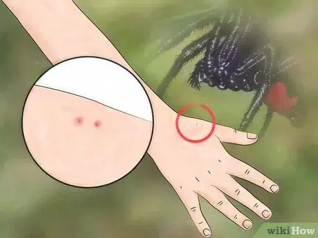 Imagen titulada Identify a Spider Bite Step 1