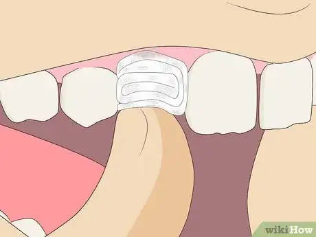 Imagen titulada Pull Out a Tooth Without Pain Step 8