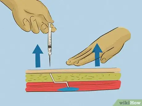Imagen titulada Give an Intramuscular Injection Step 18