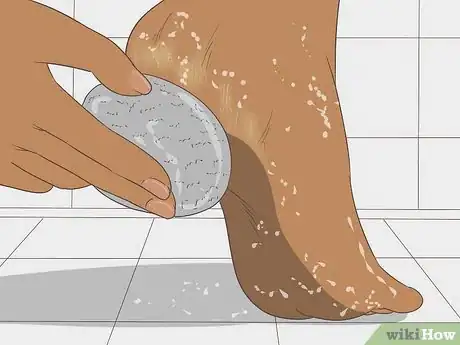 Imagen titulada Remove Dry Skin from Your Feet Using Epsom Salt Step 15