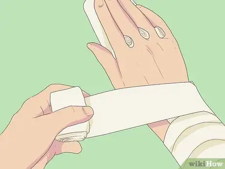 Imagen titulada Splint a Fractured Hand Step 11