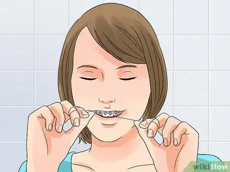 Imagen titulada Whiten Your Teeth when You Have Braces Step 3