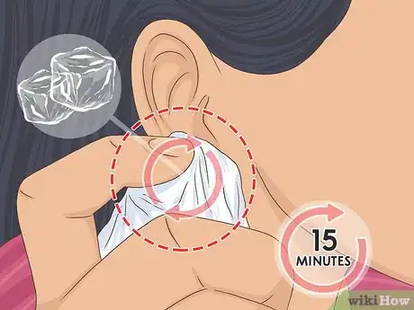 Imagen titulada Put Your Earring Back when It Won't Go in Step 4