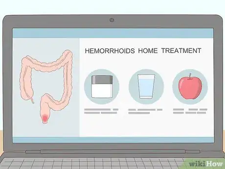 Imagen titulada Get Rid of Hemorrhoids Fast Step 4