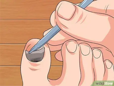 Imagen titulada Remove a Dead Toenail Step 12