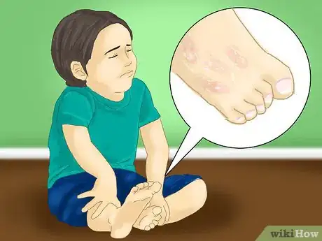 Imagen titulada Treat Foot Pain in Children Step 3