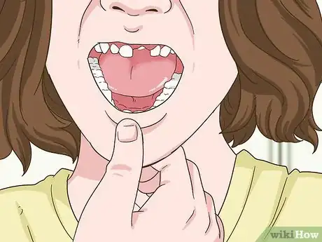 Imagen titulada Painlessly Pull Out a Loose Baby Tooth Step 12