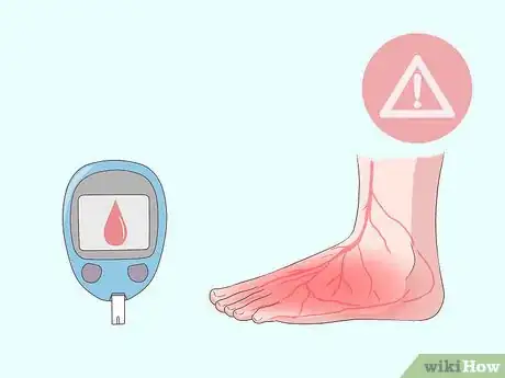 Imagen titulada Relieve Ingrown Toe Nail Pain Step 4