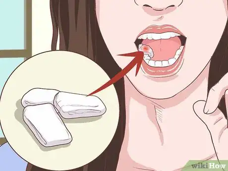 Imagen titulada Prepare for Tooth Extraction Step 15